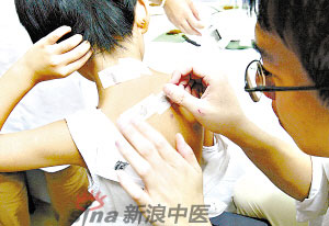 灸法的種類  你知道多少？